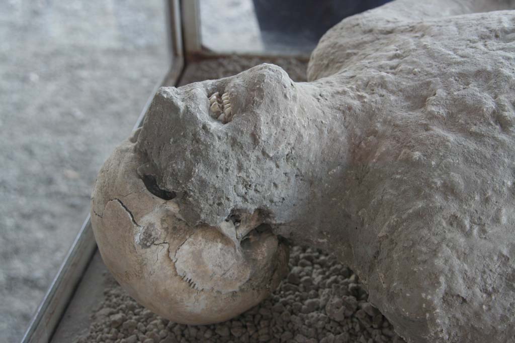 VII.9.7 and VII.9.8 Pompeii. April 2010. 
Detail of head of plaster cast of victim no.12, photographed in north-west corner of Macellum. Photo courtesy of Klaus Heese. 

