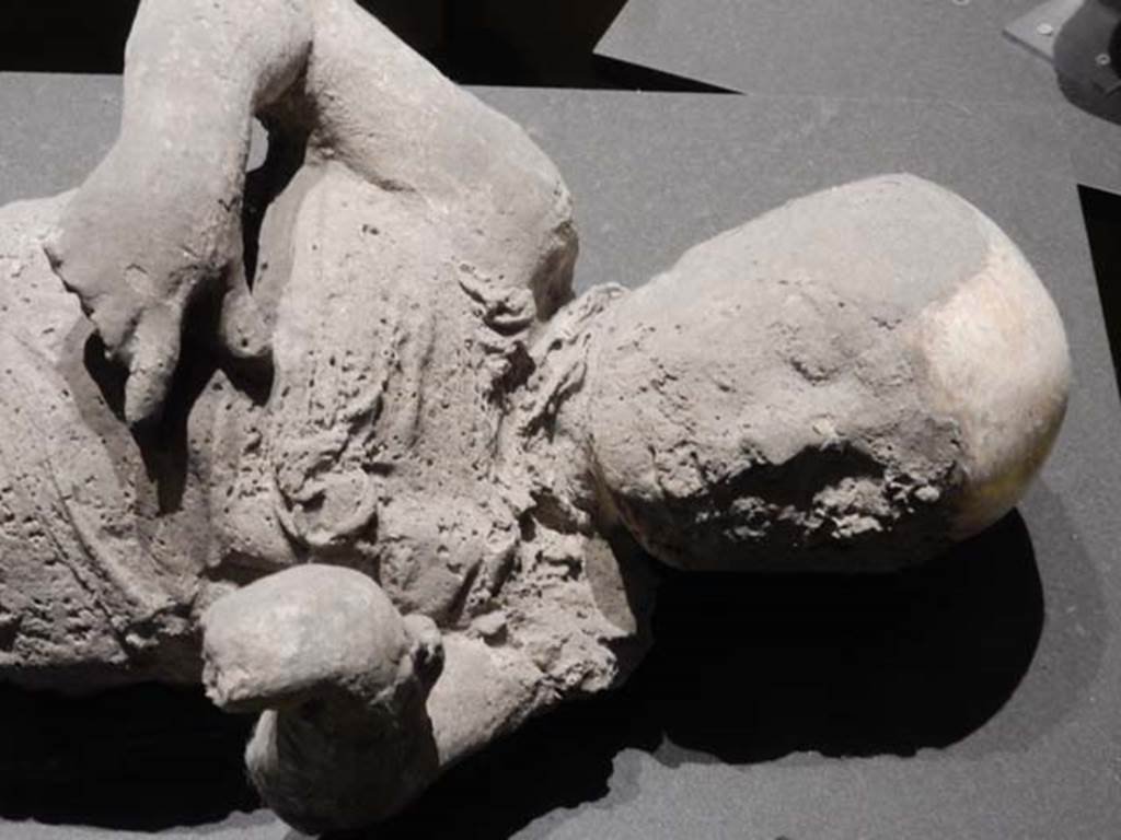 VI.17.42, Pompeii, May 2018. Detail of plaster cast of a young child. Photo courtesy of Buzz Ferebee.