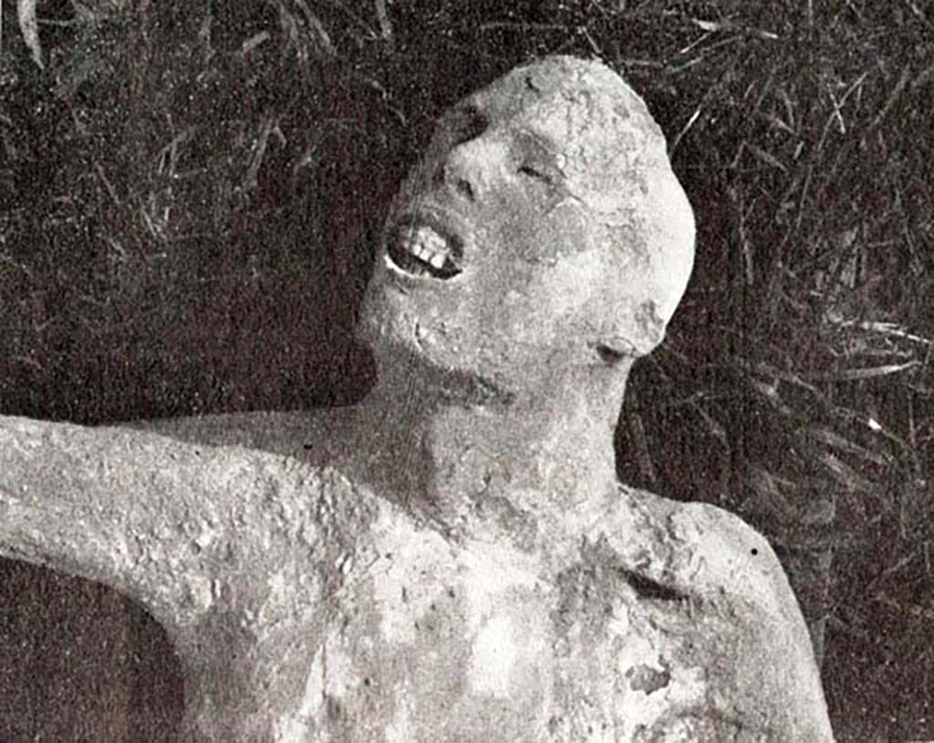 Cast of body found outside Porta Nola near tomb of Obellius Firmus. According to De Caro, the face shows the dramatic image of the pangs of death.
See De Caro S., 1976. Scavi nell’area fuori Porta Nola a Pompei: Cronache Pompeiane V, (fig. 26). 

